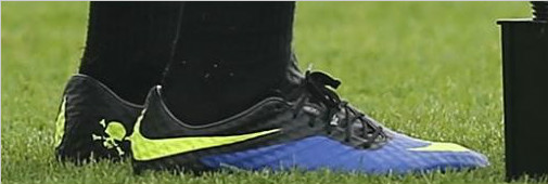 #Աʵ#.ɫHyperVenom 