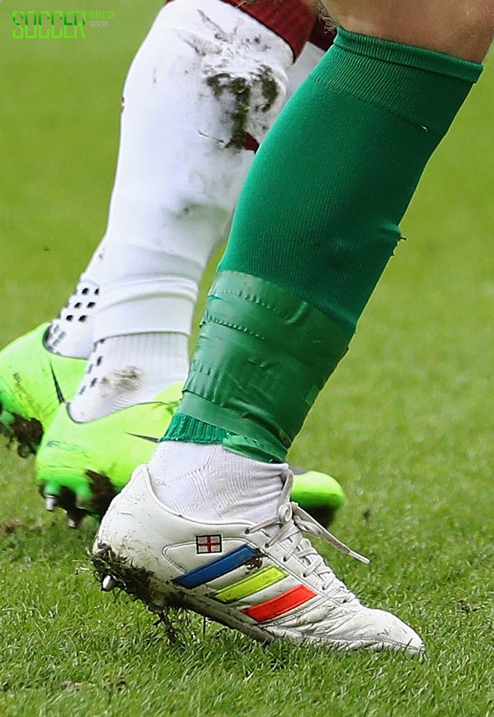 Bradley Wood (Lincoln City) adidas Gloro 16.1
